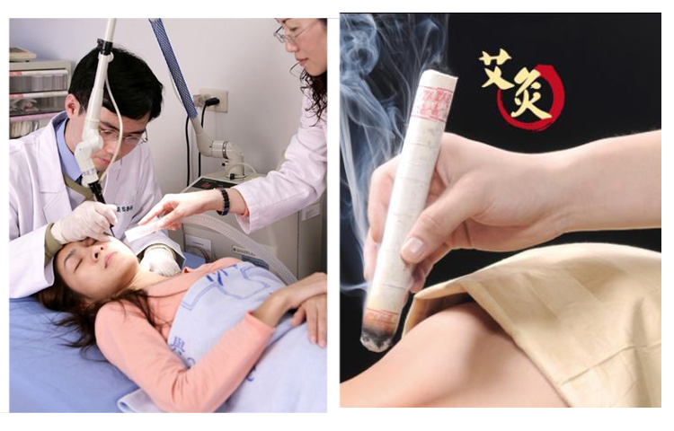 艾灸看片网站在线